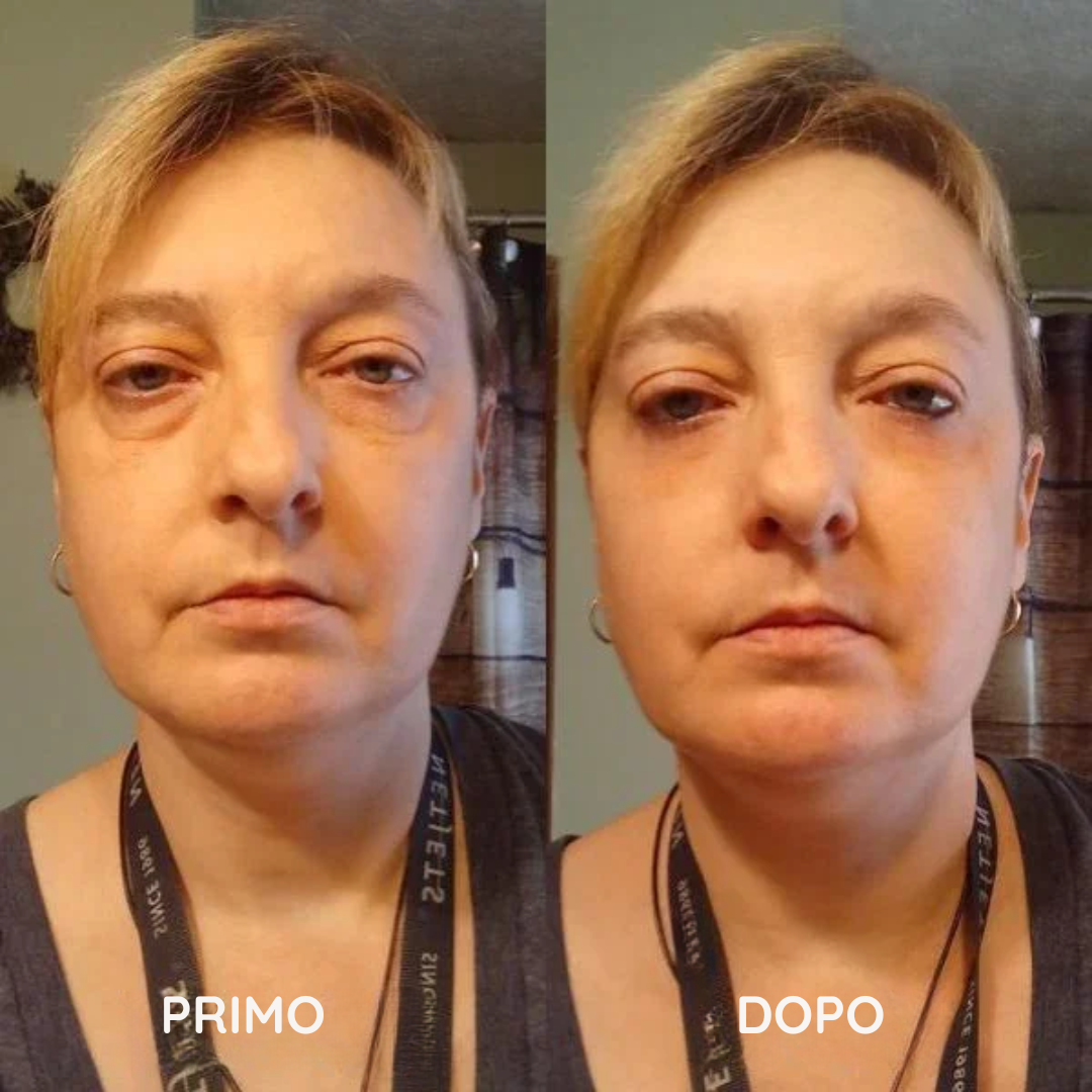 HelveOcchi™ – Patch Lifting al Collagene