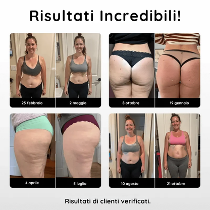 HelveLeg™