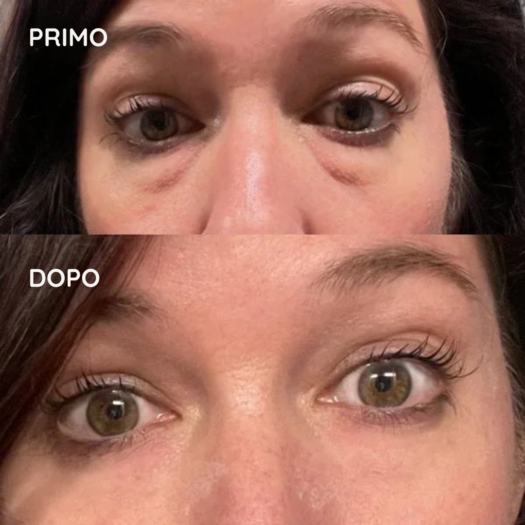 HelveOcchi™ – Patch Lifting al Collagene