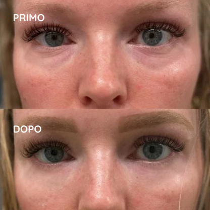 HelveOcchi™ – Patch Lifting al Collagene